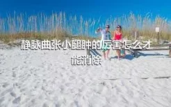 静脉曲张小腿肿的厉害怎么才能消除