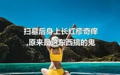 扫墓后身上长红疹奇痒,原来是这东西搞的鬼