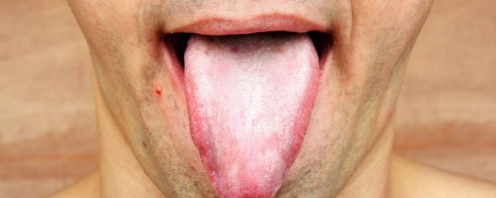 肝肾阴虚舌头有什么表现 如何养护肝肾 肝肾阴虚的调理方法
