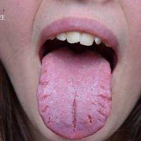 舌头边缘有齿痕是什么原因
