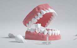 矫正牙齿的最佳年龄 带牙套的最佳年龄是多大